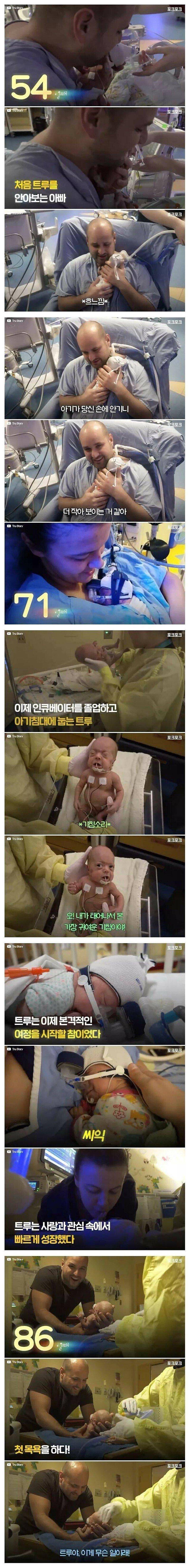 펌_14주 일찍 태어난 미숙아의 기적.jpg2