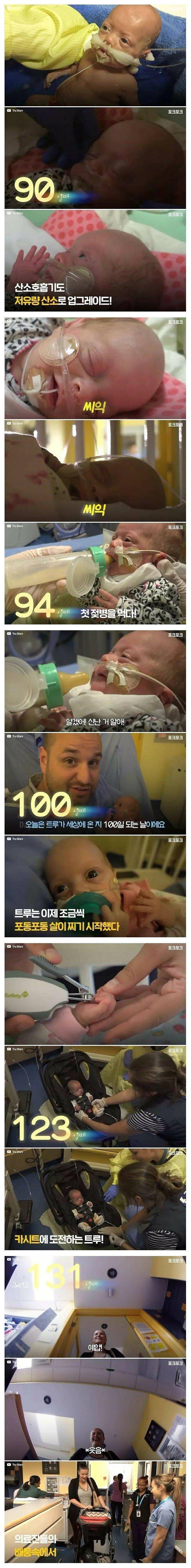 펌_14주 일찍 태어난 미숙아의 기적.jpg3