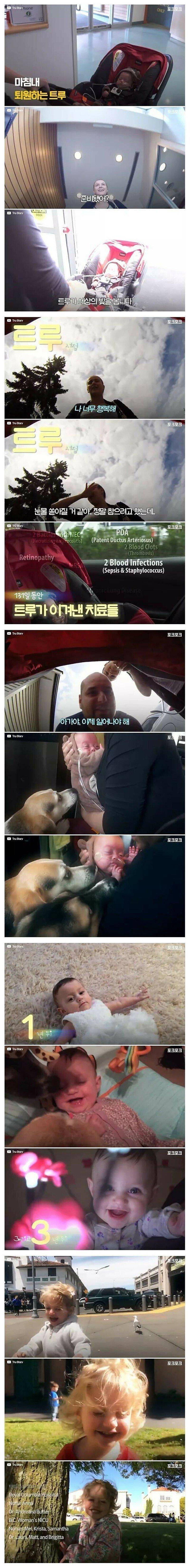 펌_14주 일찍 태어난 미숙아의 기적.jpg4