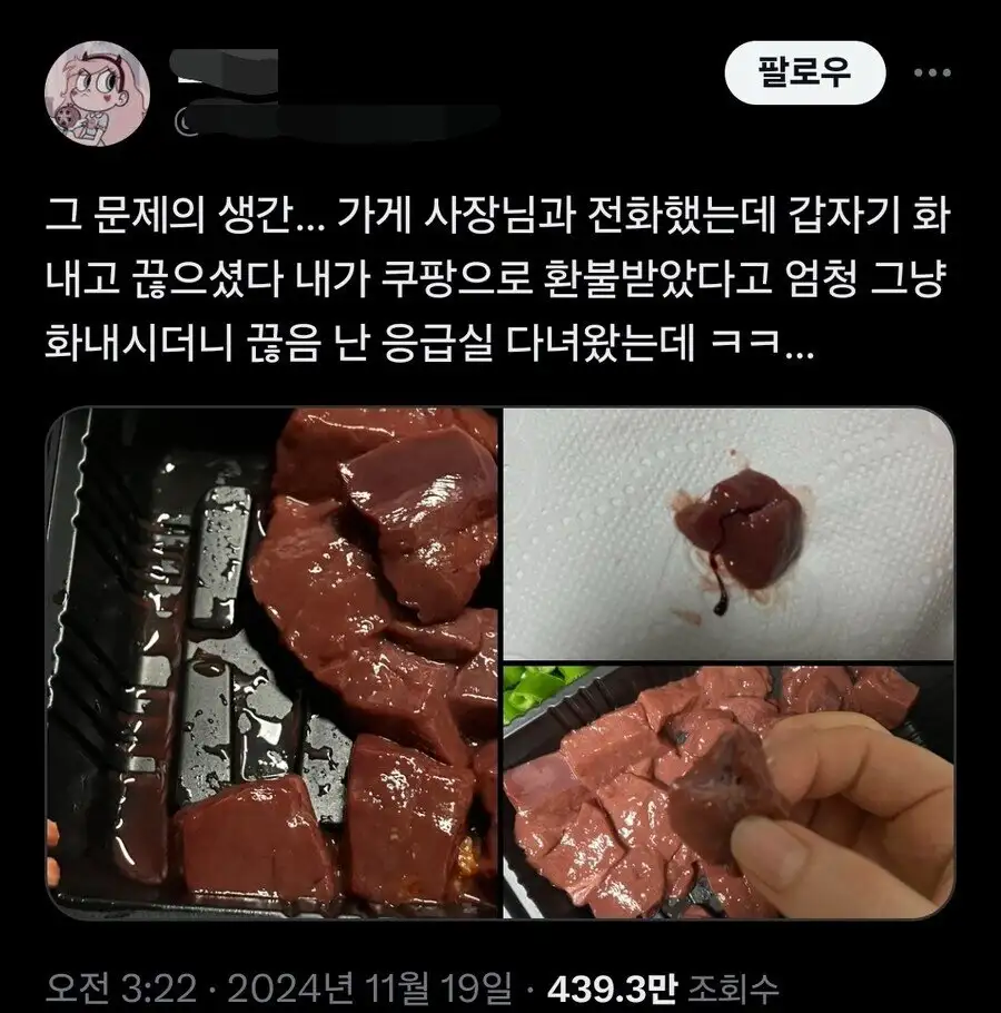 배달 생간 먹고 응급실 간 사람.x