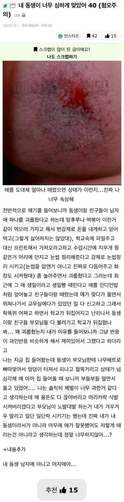 본문 이미지