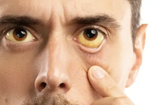 위고비같은거 없어도 진짜 살이 쭉쭉 빠지고 있다는 신호_1.jpg