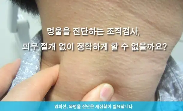 위고비같은거 없어도 진짜 살이 쭉쭉 빠지고 있다는 신호_2.jpg