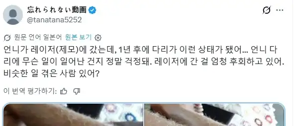 레이저 제모를 한 어느 여성에게 일어난 부작용;;_1.webp