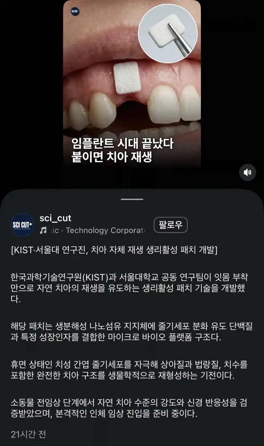오...치아 재생..._1.webp