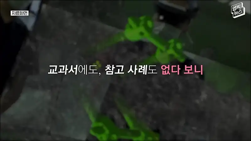 33시간 수술 끝에 얼굴 본 쌍둥이.jpg