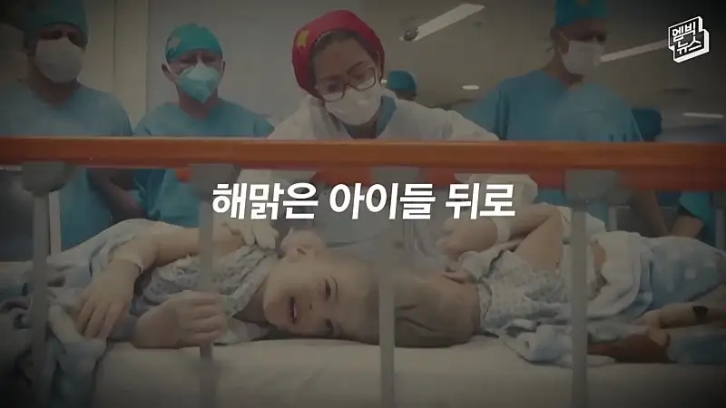 33시간 수술 끝에 얼굴 본 쌍둥이.jpg