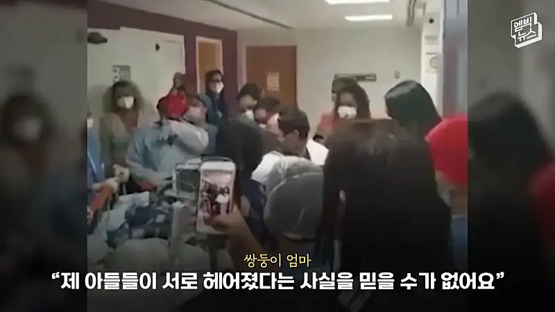 33시간 수술 끝에 얼굴 본 쌍둥이.jpg