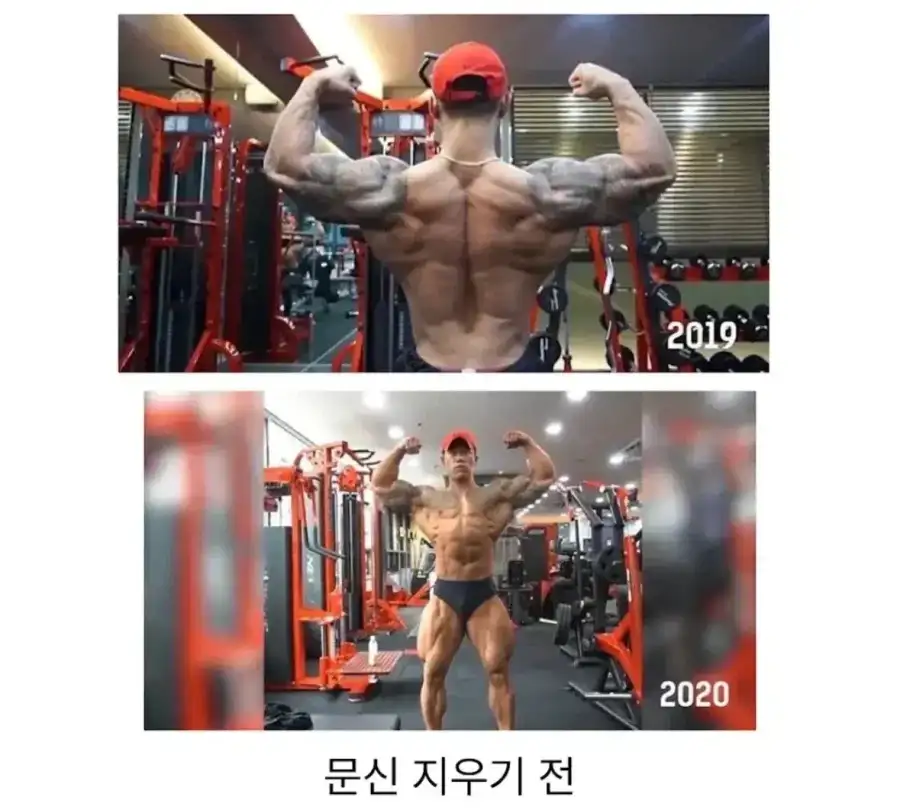 딸이 태어나고 문신을 다 지운 아빠.jpg_1.webp