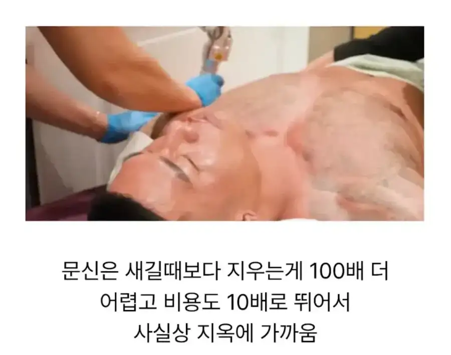 딸이 태어나고 문신을 다 지운 아빠.jpg_4.webp