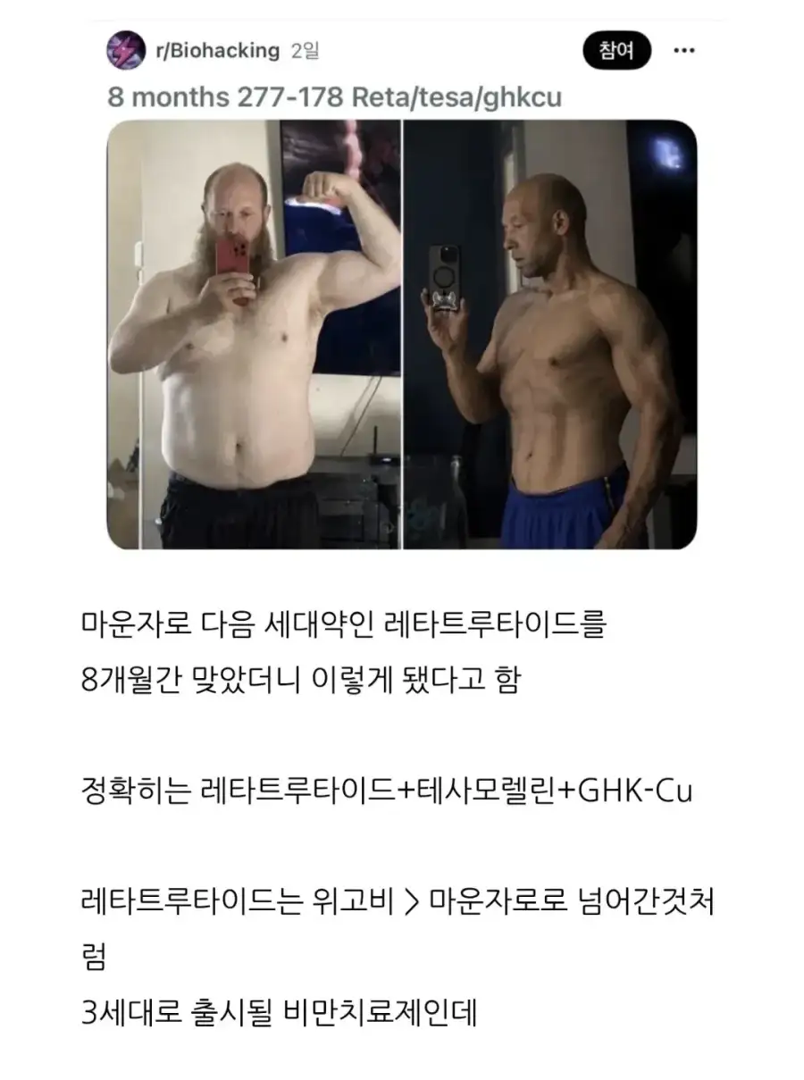 이제 비만은 가난의 상징이 될 것 같다 ㄷㄷㄷㄷㄷ_1.webp