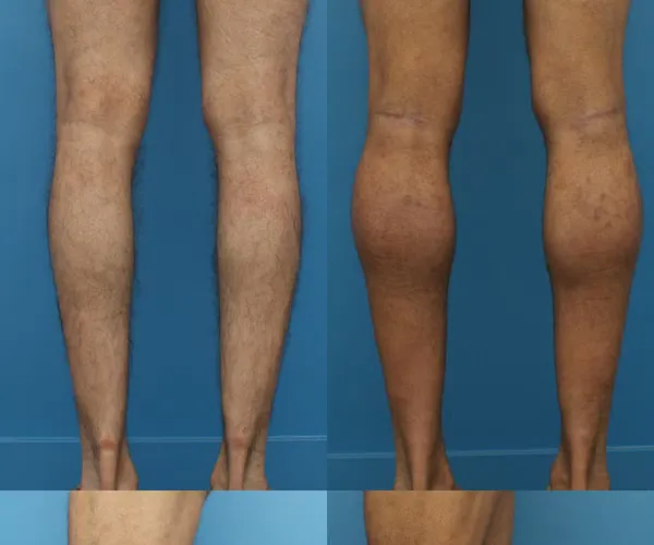 BADA.TV 바다티비